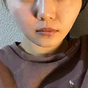 糸リフト 仙台TAクリニック AFTER サムネイル用