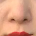 毛穴洗浄（ハイドラフェイシャルなど） 代官山ウィメンズクリニック DAY 4 サムネイル用