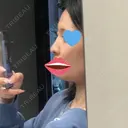 ヒアルロン酸注入（鼻） フィラークリニック 新宿院 DAY 0 サムネイル用