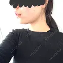 糸リフト / バッカルファット除去 / 脂肪吸引（顔） / メーラーファット除去 / 脂肪吸引注射（顔） SEA CLINIC（シークリニック） DAY 31 サムネイル用