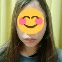 ボトックス（あご） / ヒアルロン酸注入（あご） 高崎TAクリニック AFTER サムネイル用