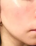 ルメッカ 豊洲内科・糖尿病 / 形成・美容外科クリニック DAY 4 サムネイル用