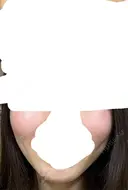 糸リフト / 脂肪吸引（顔） / ジョールファット除去 / ボトックス（エラ・小顔） ルラ美容クリニック 新宿院 DAY 127 サムネイル用