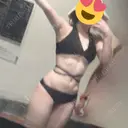脂肪吸引（お腹） オアシス美容外科 DAY 47 サムネイル用