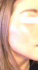 ルメッカ 豊洲内科・糖尿病 / 形成・美容外科クリニック AFTER サムネイル用