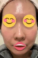 ポテンツァ 9BeautyClinic DAY 3 サムネイル用