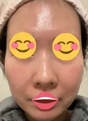 ポテンツァ 9BeautyClinic DAY 4 サムネイル用