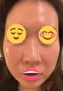 ポテンツァ 9BeautyClinic DAY 6 サムネイル用