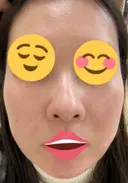 ポテンツァ 9BeautyClinic DAY 6 サムネイル用