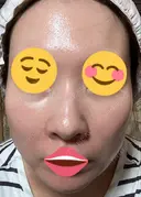 ポテンツァ 9BeautyClinic DAY 7 サムネイル用