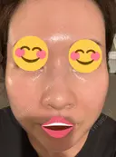 ポテンツァ 9BeautyClinic DAY 8 サムネイル用