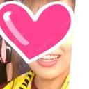 ヒアルロン酸注入（あご） 加藤クリニック麻布 大阪院 DAY 5 サムネイル用