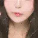 肌ヒアルロン酸注入（たるみ・シワ改善） / ヒアルロン酸注入（唇） TCB東京中央美容外科 中野院 DAY 0 サムネイル用