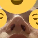 鼻尖形成（切開） / 軟骨移植 / 鼻修正 / 鼻柱下降・鼻唇角形成（猫手術） 東京シンデレラ美容外科 池袋院 DAY 46 サムネイル用