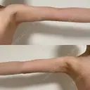 豊胸（シリコン＋脂肪併用） Casa de GRACIA GINZA 【カーサデグラシアギンザ】 DAY 181 サムネイル用