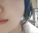 ボトックス（エラ・小顔） 湘南美容クリニック 本厚木院 DAY 59 サムネイル用