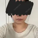 糸リフト / バッカルファット除去 / 脂肪吸引（顔） / メーラーファット除去 / 脂肪吸引注射（顔） SEA CLINIC（シークリニック） DAY 66 サムネイル用