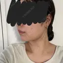 糸リフト / バッカルファット除去 / 脂肪吸引（顔） / メーラーファット除去 / 脂肪吸引注射（顔） SEA CLINIC（シークリニック） DAY 66 サムネイル用