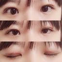 二重切開 / 上まぶたの脂肪取り 聖心美容クリニック 横浜院 DAY 18 サムネイル用