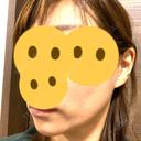 ボトックス（エラ・小顔） Wi Clinic（ウィ クリニック） 吉祥寺院 DAY 8 サムネイル用