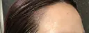アートメイク（ヘアライン） Tokyo Tensei Clinic 新宿院 DAY 0 サムネイル用