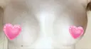 豊胸（シリコンバッグ） ジョウクリニック 那覇院 AFTER サムネイル用