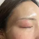 アートメイク（眉） 共立美容外科 浜松院 AFTER サムネイル用