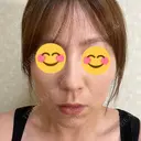 脂肪吸引（顔） / 脂肪吸引（お腹） / 豊胸（脂肪注入） / 脂肪注入（肌） / 乳頭縮小 / 脂肪吸引（腰） / ボトックス（エラ・小顔） Mods Clinic（モッズクリニック） 大阪院 DAY 83 サムネイル用