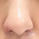 鼻孔縁挙上 大阪TAクリニック DAY 7 サムネイル用