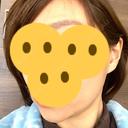 ボトックス（エラ・小顔） Wi Clinic（ウィ クリニック） 吉祥寺院 DAY 12 サムネイル用
