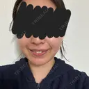 糸リフト / バッカルファット除去 / 脂肪吸引（顔） / メーラーファット除去 / 脂肪吸引注射（顔） SEA CLINIC（シークリニック） DAY 75 サムネイル用
