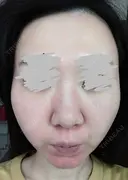 ポテンツァ 9BeautyClinic AFTER サムネイル用