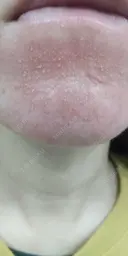 ポテンツァ 9BeautyClinic DAY 1 サムネイル用