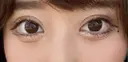 二重埋没 / ヒアルロン酸注入（涙袋） Olino美容外科・美容皮膚科 DAY 9 サムネイル用