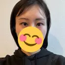 ボトックス（目尻） TCB東京中央美容外科 梅田茶屋町院 DAY 24 サムネイル用