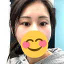 ボトックス（目尻） TCB東京中央美容外科 梅田茶屋町院 DAY 77 サムネイル用