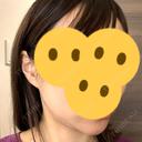 ボトックス（エラ・小顔） Wi Clinic（ウィ クリニック） 吉祥寺院 DAY 20 サムネイル用