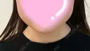 ボトックス（エラ・小顔） / ボトックス（口角） / ボトックス（肩） M'sクリニック【エムズクリニック】 DAY 60 サムネイル用