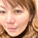 脂肪溶解注射（顔） / ヒアルロン酸注入（頬） / ボトックス（眉間） / ボトックス（目尻） / ハイフ（顔） TCB東京中央美容外科 立川院 AFTER サムネイル用