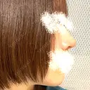 鼻尖形成（切開） / 小鼻縮小（切開） / 軟骨移植 / 鼻尖縮小 高崎美容クリニック DAY 373 サムネイル用