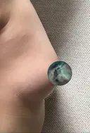 脂肪吸引（お腹） / 脂肪吸引（お尻） / 豊胸（脂肪注入） / その他（ボディ） ドクターフィット（Dr.fit）クリニック DAY 121 サムネイル用