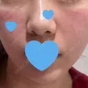 ポテンツァ ARTE BEAUTY CLINIC DAY 1 サムネイル用