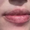 ルビーレーザー S-Laboクリニック 渋谷院 DAY 0 サムネイル用