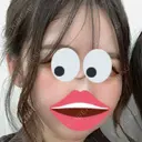 ボトックス（エラ・小顔） / ボトックス（肩） ルラ美容クリニック 大阪本院 AFTER サムネイル用