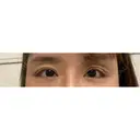 目尻靭帯移動 ヴェリテクリニック 銀座院 DAY 21 サムネイル用