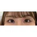 目尻靭帯移動 ヴェリテクリニック 銀座院 DAY 30 サムネイル用