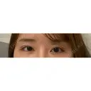 目尻靭帯移動 ヴェリテクリニック 銀座院 AFTER サムネイル用