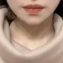 骨切り（あご） / 輪郭修正 / 脂肪溶解注射（顔） 心斎橋コムロ美容外科クリニック AFTER サムネイル用