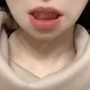 骨切り（あご） / 輪郭修正 / 脂肪溶解注射（顔） 心斎橋コムロ美容外科クリニック DAY 1927 サムネイル用