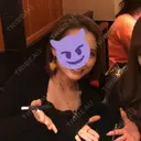 あごプロテーゼ 湘南美容クリニック 池袋西口院 AFTER サムネイル用